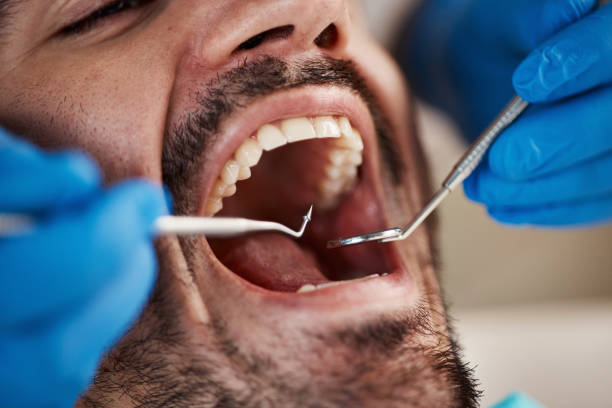 Best Emergency Dentist for Knocked-Out Tooth in Timberwood Park, TX